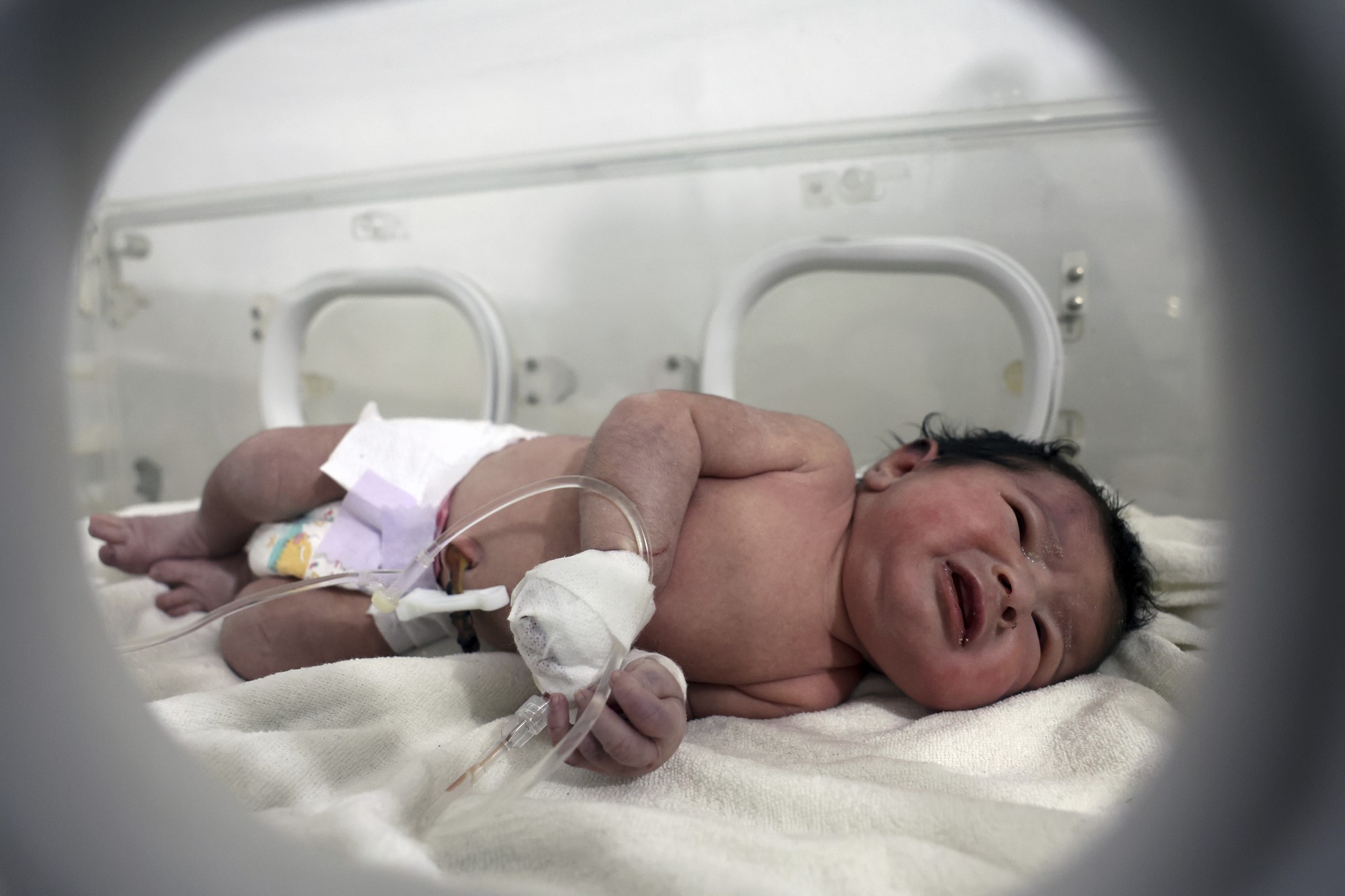 A baby girl who was born under the rubble receives treatment at a children's hospital in Syria.