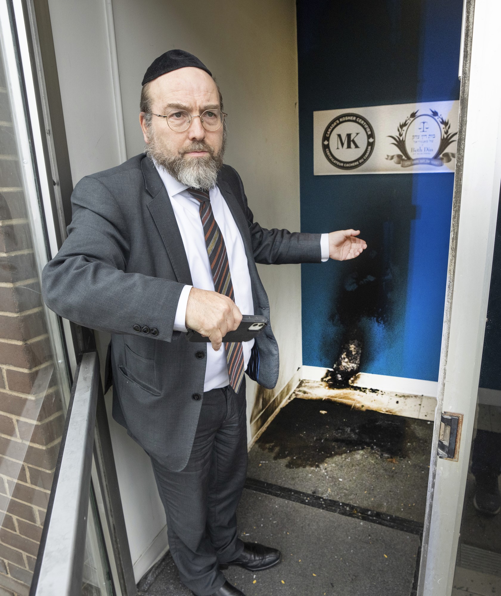 A Jewish man shows scorches in the doorway of the centre