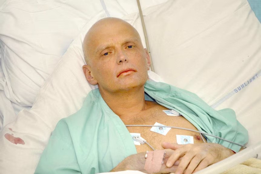 A bald man with a green hospital gown draped around and several wires stuck to his chest lays in a hospital bed